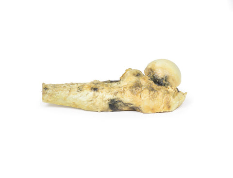 Osteosarcom femural