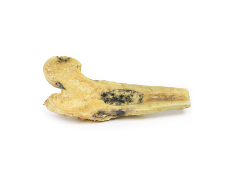 Osteosarcom femural