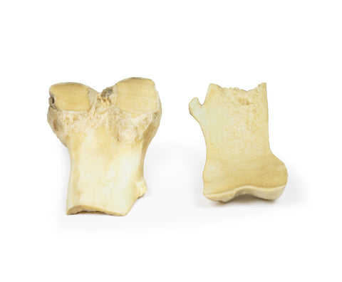 Osteocondrom