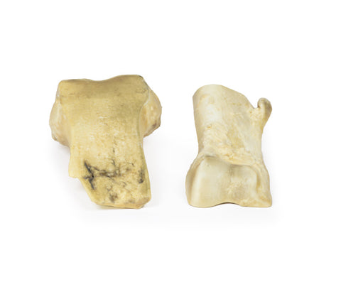 Osteocondrom