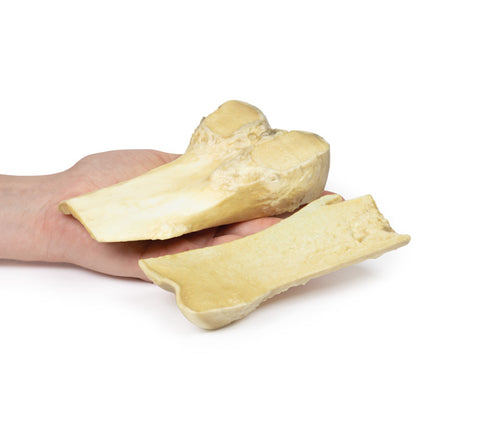 Osteocondrom