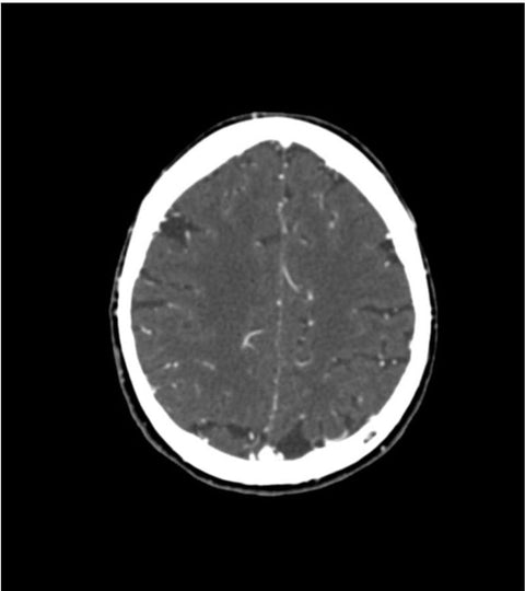 Fantomă cap pentru angiografie CT