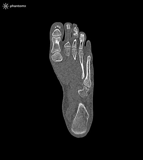 Fantomă picior pentru CT, radiografie și radioterapie