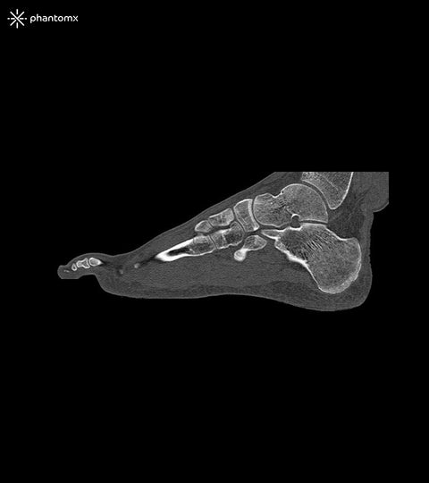 Fantomă picior pentru CT, radiografie și radioterapie