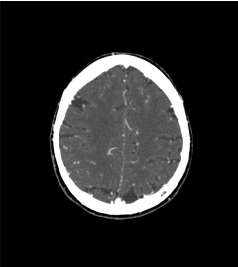 Fantomă de cap și gât pentru CT, radiografie și radioterapie