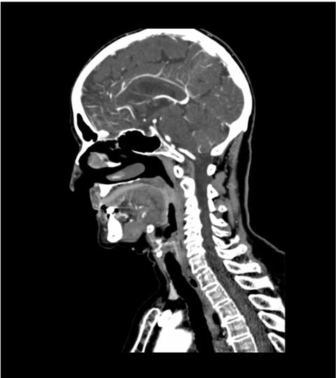 Fantomă de cap și gât pentru CT, radiografie și radioterapie