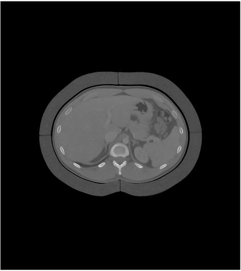 Inel adipos de 2,5 cm pentru fantoma abdominală