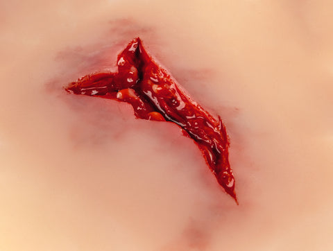 Moulage rană "lacerație"