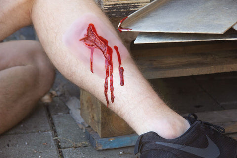 Wound moulage "laceration"