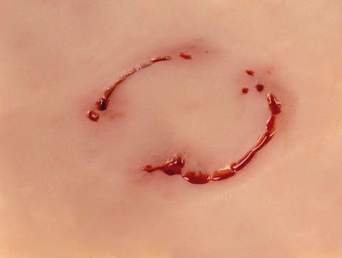 Moulage rană "mușcătură umană"