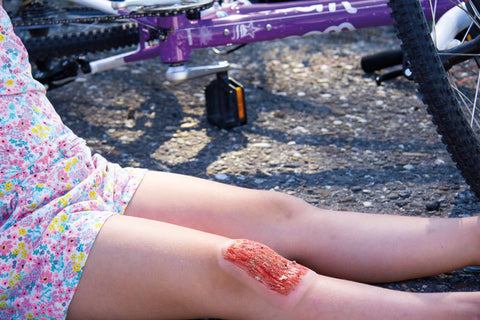 Wound moulage "abrasion"