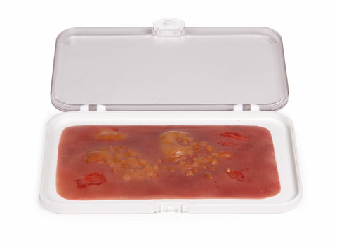 Wound moulage 2nd degree burn