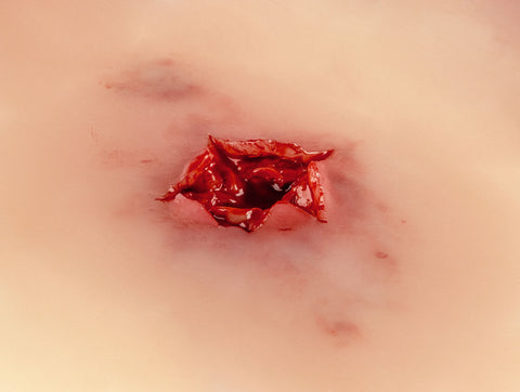 Moulage rană gaură de ieșire glonț