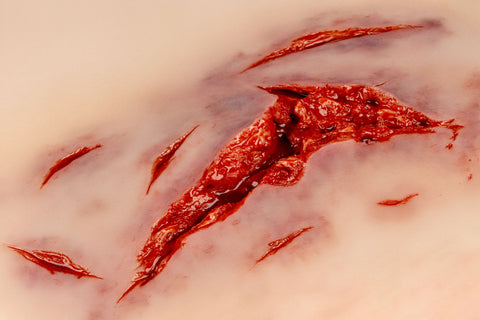 Moulage lacerație, mare cu funcție de sângerare