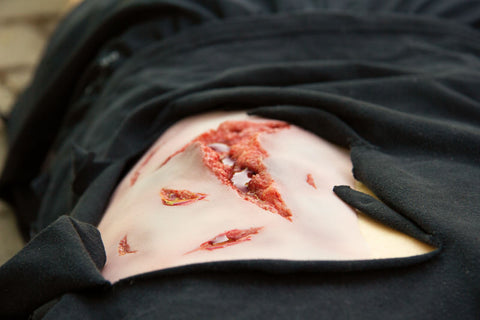 Moulage lacerație, mare cu funcție de sângerare