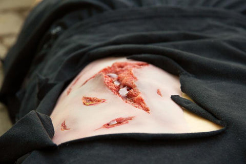 Moulage lacerație, mare cu funcție de sângerare