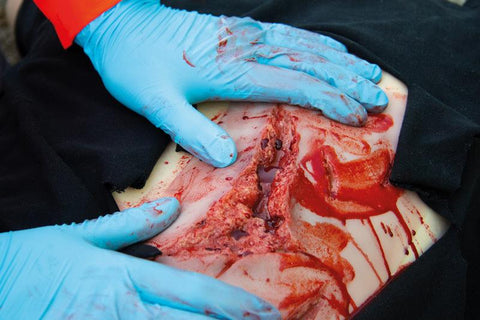 Moulage lacerație, mare cu funcție de sângerare