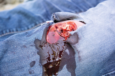 Wound moulage open fracture, leg with bleeding function