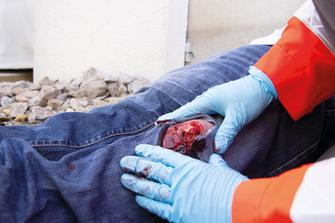 Wound moulage open fracture, leg with bleeding function