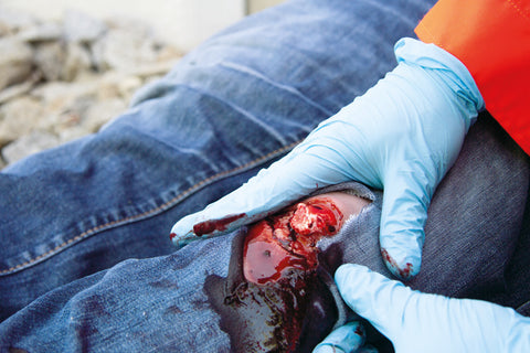 Wound moulage open fracture, leg with bleeding function