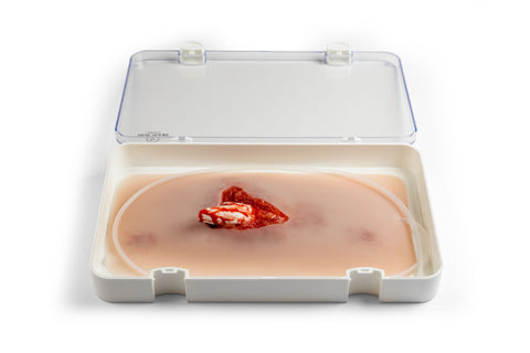 Moulage fractură deschisă, picior cu funcție de sângerare