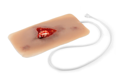 Moulage fractură deschisă, picior cu funcție de sângerare