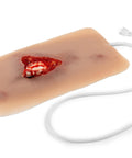 Moulage fractura deschisă, picior cu funcție de sângerare