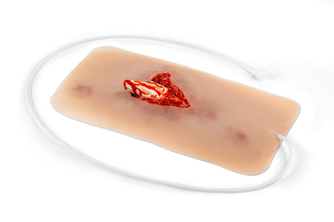 Moulage fractură deschisă, picior cu funcție de sângerare