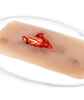 Moulage fractura deschisă, picior cu funcție de sângerare