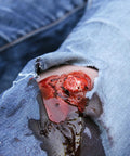 Moulage fractura deschisă, picior cu funcție de sângerare
