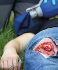 Moulage fractura deschisă, picior cu funcție de sângerare