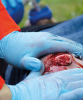 Moulage fractura deschisă, picior cu funcție de sângerare