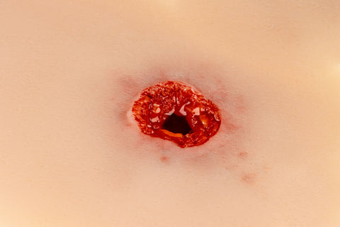 Moulage rană glonț, braț cu funcție de sângerare