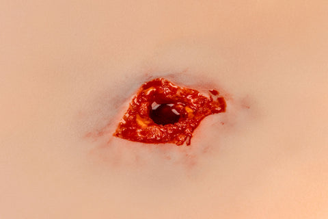Moulage gaură de glonț, picior cu funcție de sângerare