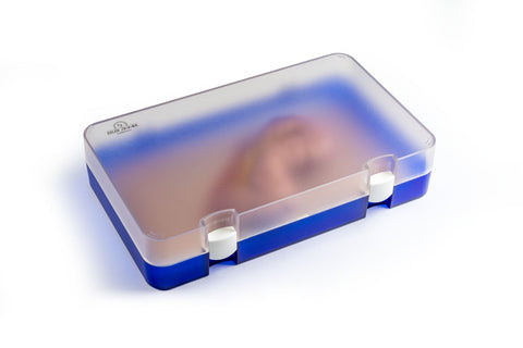 Moulage protruziune intestin gros