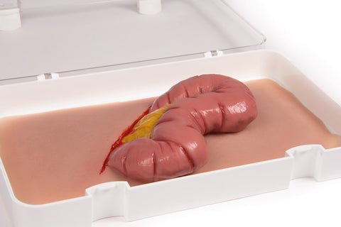 Wound moulage protrusion of large intestines