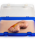 Moulage protruziune intestin gros