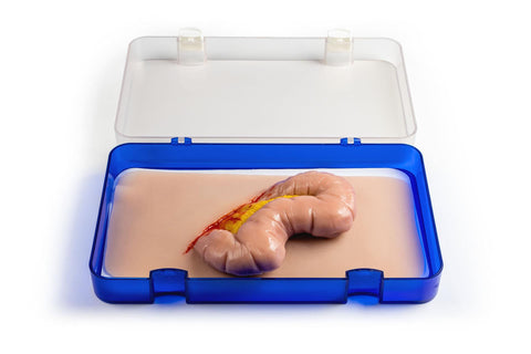 Moulage protruziune intestin gros