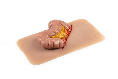 Moulage protruziune intestin gros