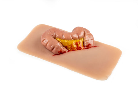 Moulage protruziune intestin gros