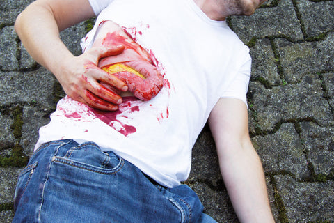 Moulage protruziune intestin gros