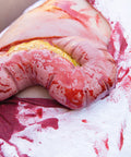Moulage protruziune intestin gros