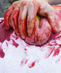 Moulage protruziune intestin gros