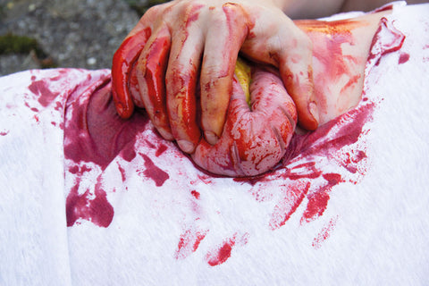 Moulage protruziune intestin gros
