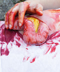 Moulage protruziune intestin gros