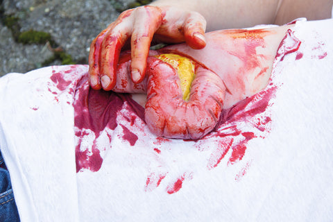 Moulage protruziune intestin gros