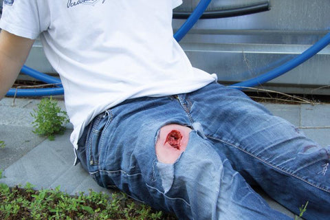 Moulage rână umplere rană