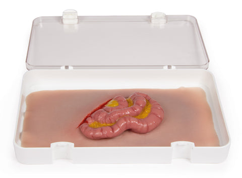 Moulage protruzie intestin subțire