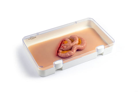 Moulage protruzie intestin subțire
