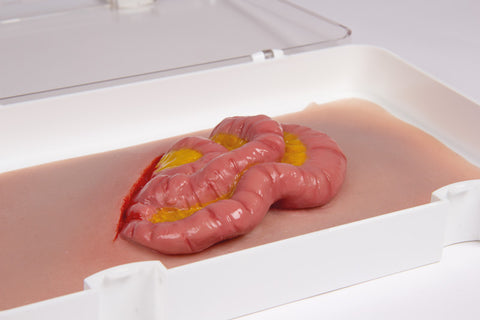Moulage protruzie intestin subțire
